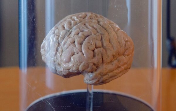 Visit Lima's brain museum